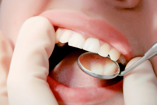 歯科医師による口腔内チェック